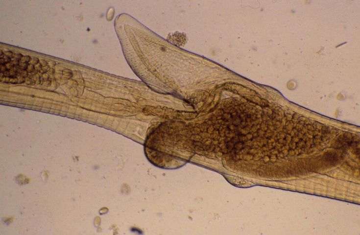 Penyakit parasit cacing haemonchus contortus menjadi penyakit ternak ruminansia yang berbahaya